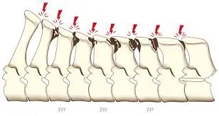 Conflit de processus épineux des equides
